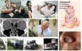 Aula 3 - A medicina do Sono e as Interfaces ente ORL e Fono.
